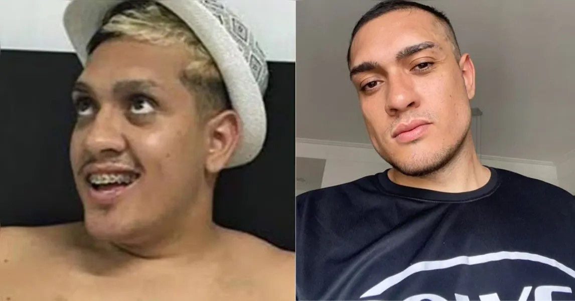 MC Binn perde mais de 50 kg sem cirurgia; veja antes e depois!