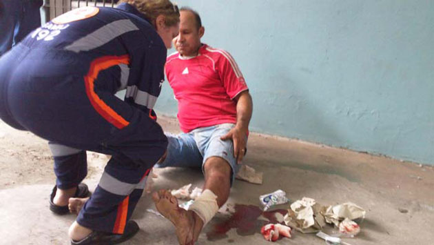 
        
            Torno cai em cima de perna de pescador
        
    