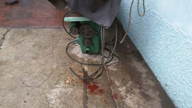 
        
            Torno cai em cima de perna de pescador
        
    