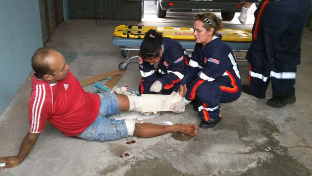 
        
            Torno cai em cima de perna de pescador
        
    