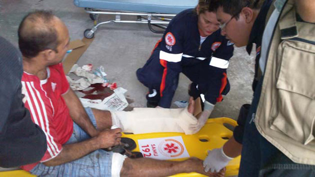 
        
            Torno cai em cima de perna de pescador
        
    
