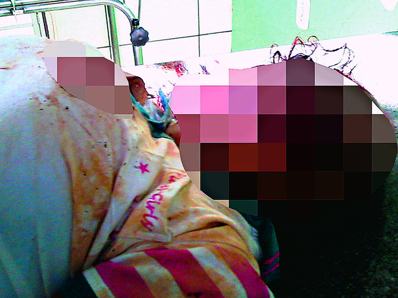 
        
            Acidente mata adolescente de apenas 14 anos
        
    