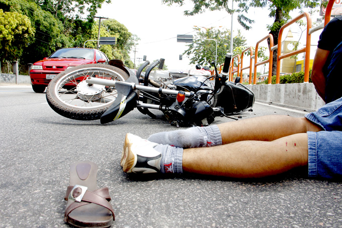 
        
            Motociclista cai de veículo e quebra o braço
        
    