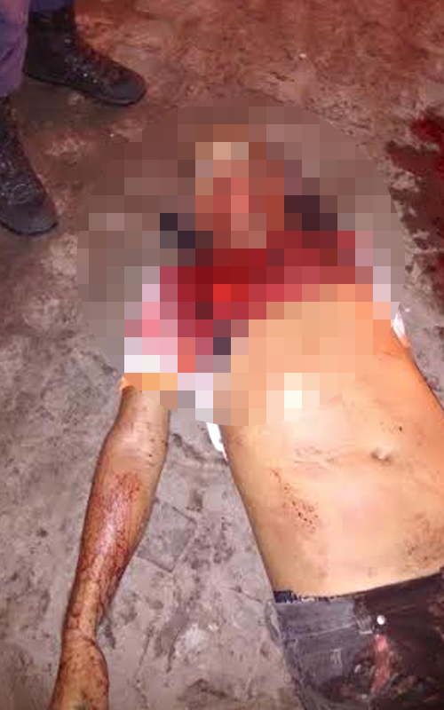 
        
            Guarda esfaqueado no pescoço é sepultado
        
    