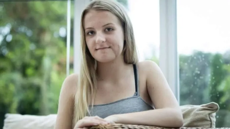 Emily Eccles fraturou o lado esquerdo da mandíbula quando andava a cavalo.