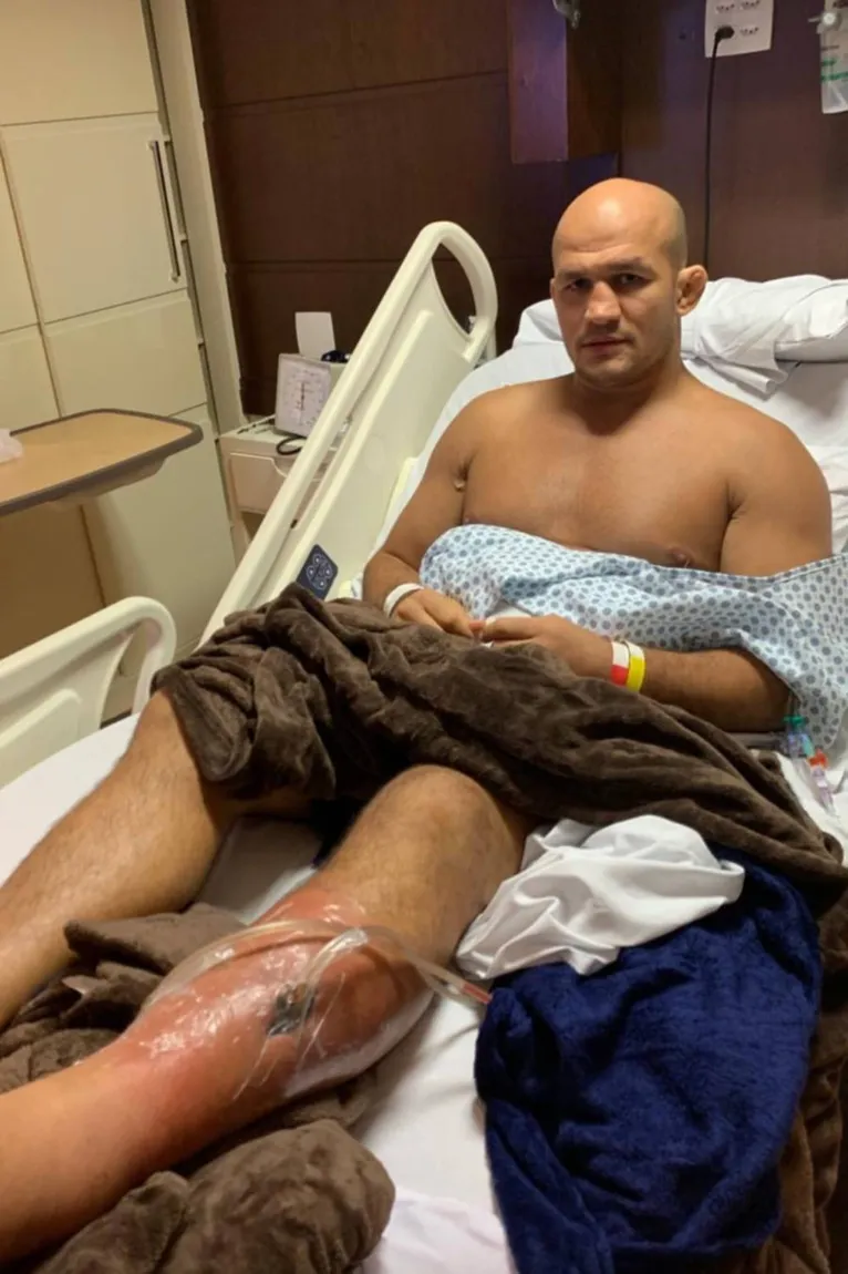 Assustador! Junior Cigano mostra buraco gigante na perna causado por bactéria