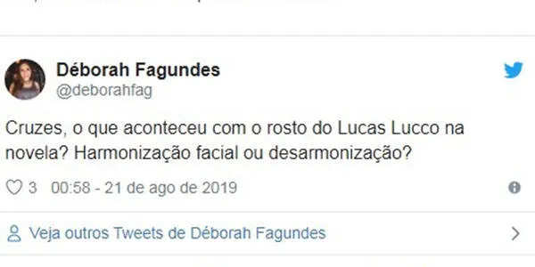Lucas Lucco é criticado por fãs após realizar harmonização facial