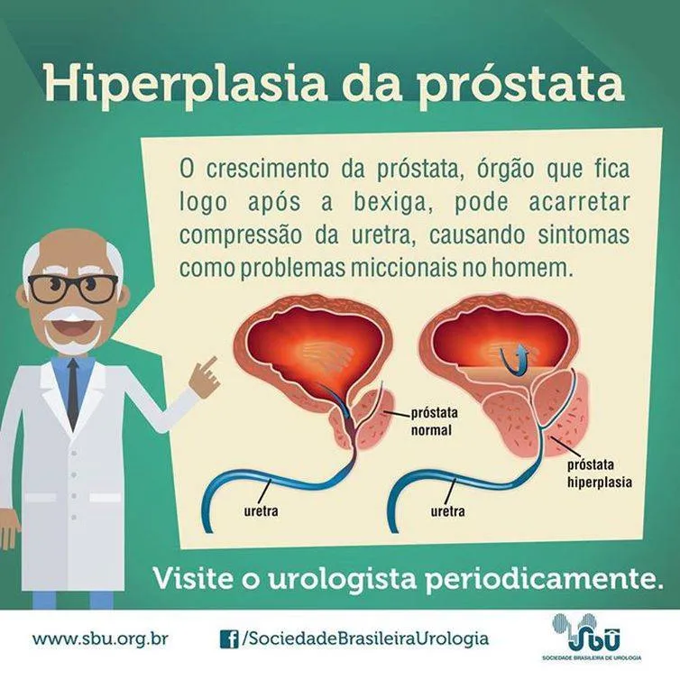 Novembro Azul: um em cada seis homens tem câncer de próstata no Brasil