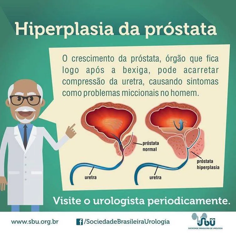 Um em cada seis homens tem câncer de próstata no Brasil