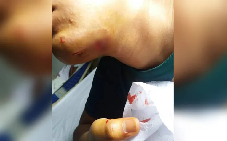 Primo de vereador sofre surto psicótico e é morto a tiros por PM