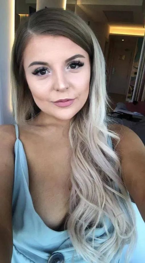 Bethany sofreu um acidente em casa após cozinhar um ovo no micro-ondas