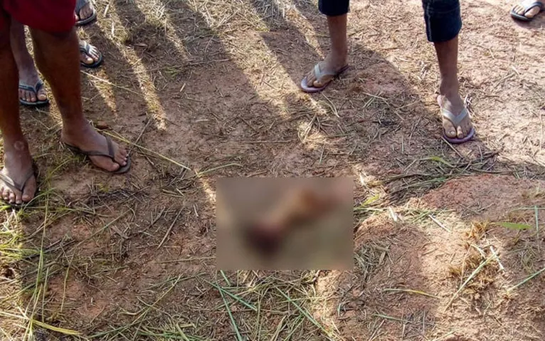 Adolescente tem braço e perna decepados por avião em Ipixuna; imagens fortes