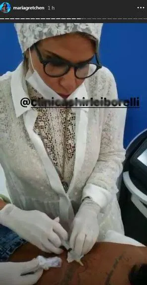 Cantora faz procedimento para remover tatuagem nas costas
