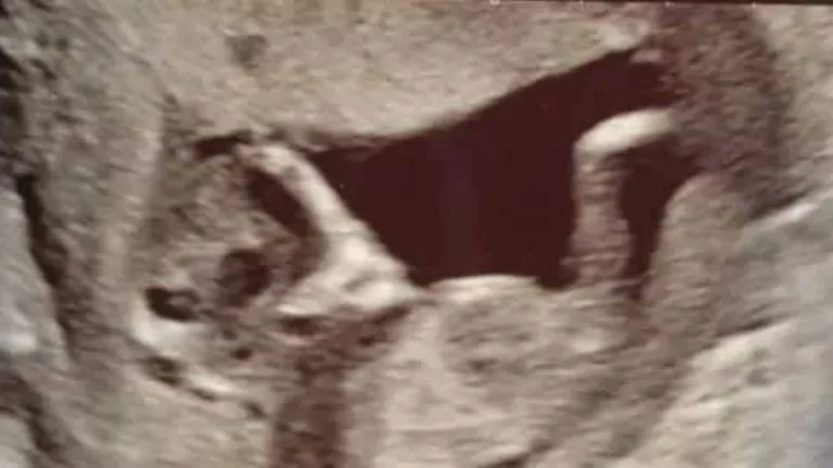 Apesar das imagens, a médica garantiu que estava tudo bem com a criança.