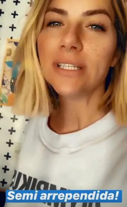 Giovanna Ewbank assusta fãs ao surgir com a boca torta após anestesia