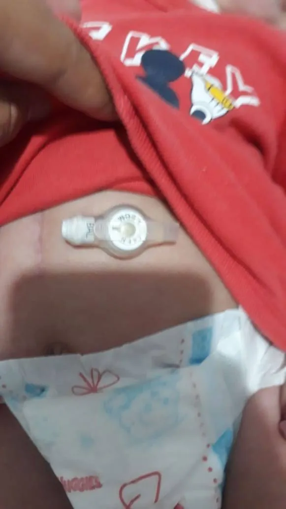 Mãe faz campanha para comprar sonda para o filho especial em Belém
