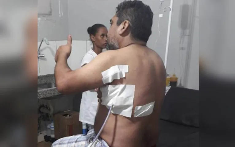 Policial é esfaqueado ao intervir em briga de casal no Pará