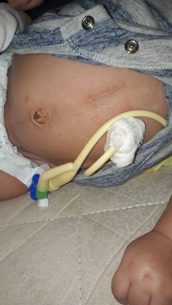 Mãe faz campanha para comprar sonda para o filho especial em Belém