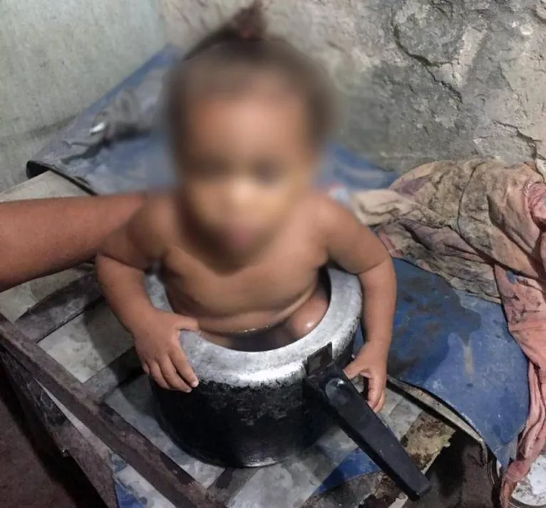 Criança é resgatada pelos Bombeiros após ficar presa em panela de pressão