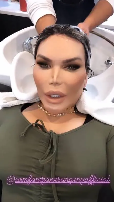 Ken que virou bárbie, mostra silicone nos seios e se diz “mais feminina”
