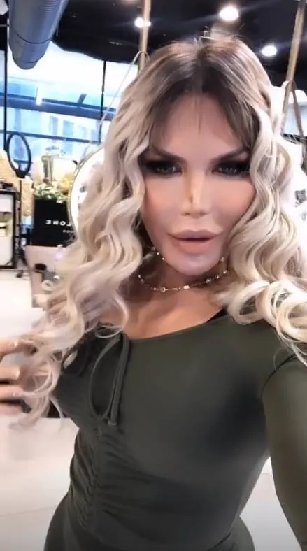 Ken que virou bárbie, mostra silicone nos seios e se diz “mais feminina”