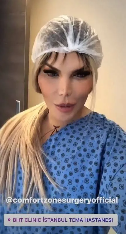 Ken que virou Bárbie mostra resultado após passar por feminilização facial