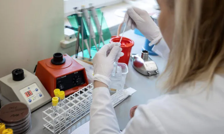 Anvisa aprova três novos testes para diagnóstico do novo coronavírus