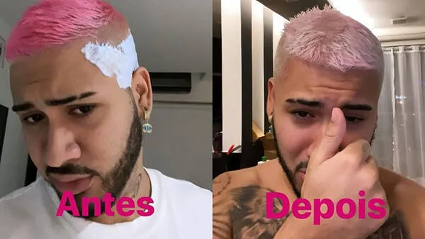 MC Kevinho mostra 'catástrofe' após descolorir o cabelo; veja o antes e depois!