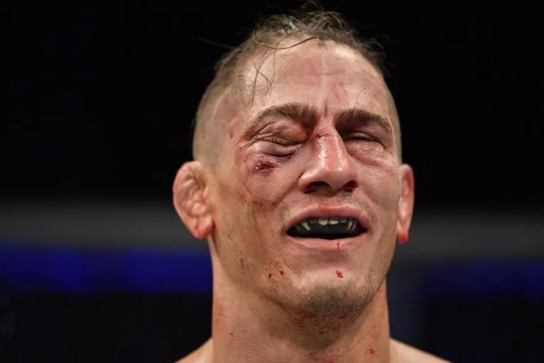 O médico do UFC precisou interromper o combate
