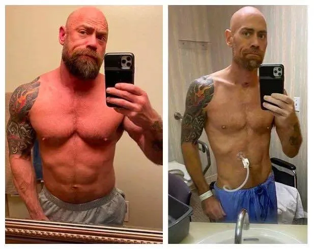 Antes e depois de Mike ser diagnosticado com covid-19