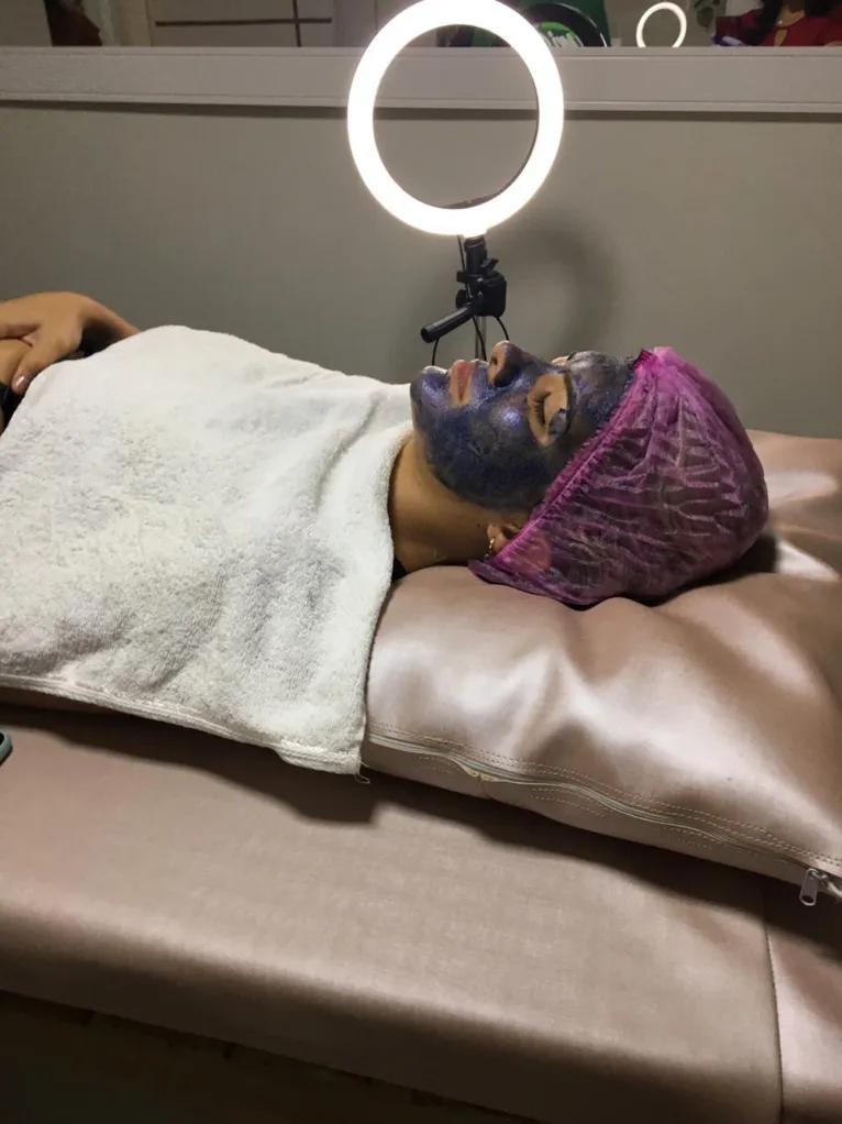 Procedimento de peeling 
