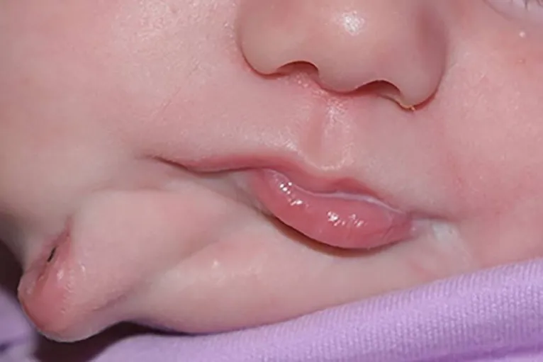 A segunda boca tinha lábios, dentes, uma língua pequena e saliva.