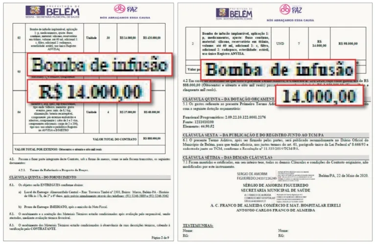 Zenaldo compra bombas de infusão com preços turbinados