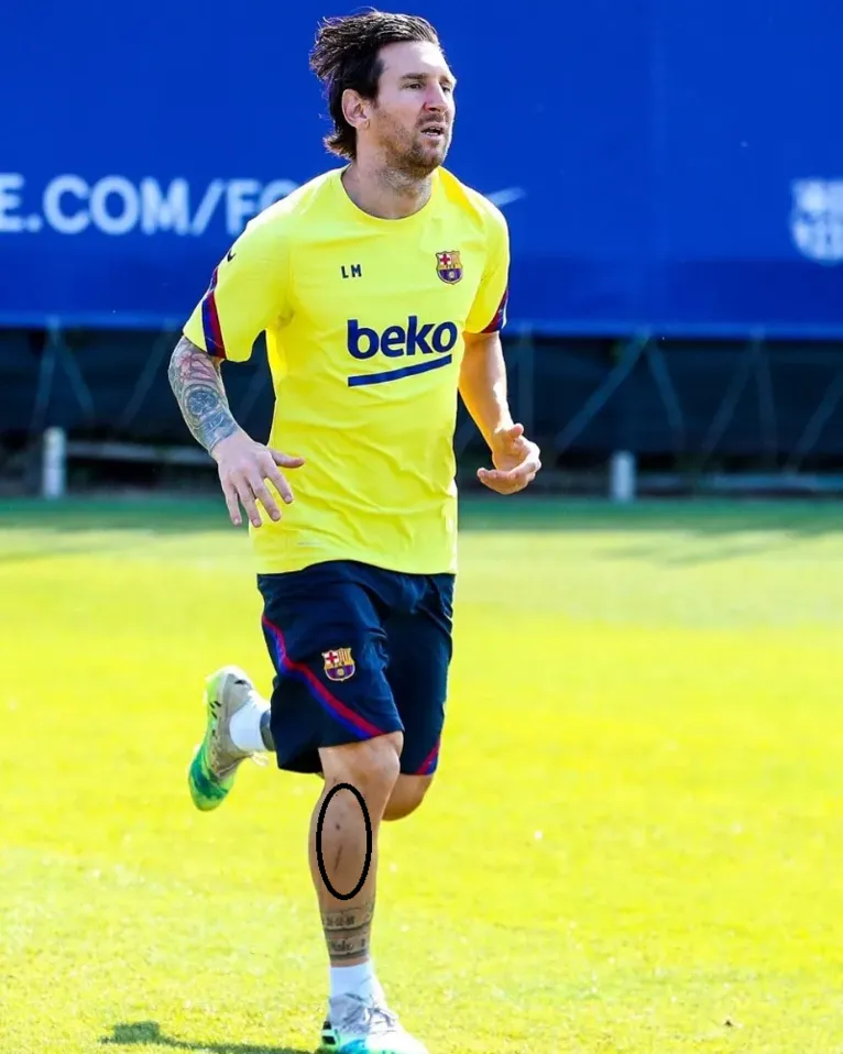Messi retornou aos treinos no último domingo com marcas da perna direita