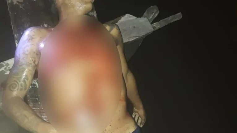 Em razão da imagem forte, o DOL preferiu esconder as marcas de sangue apresentada na foto
