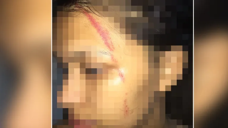 A garçonete ficou com o rosto ferido após ser agredida pelo policial. 