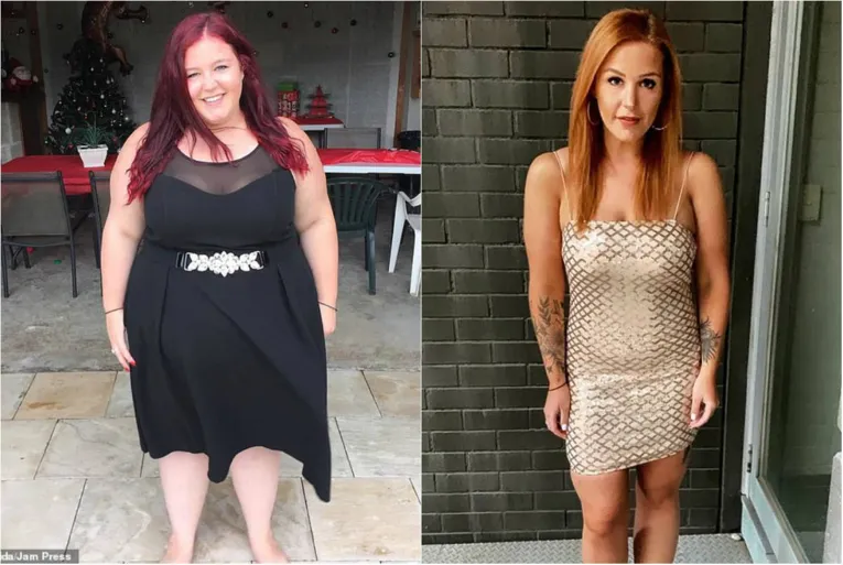 Mulher perde 80 kg depois de terminar 'relacionamento tóxico'