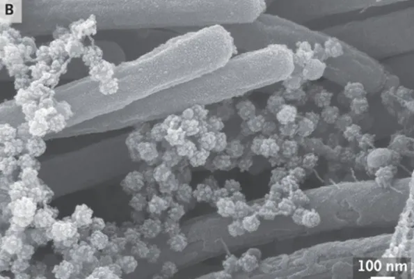 Imagem inédita mostra infecção por coronavírus nas vias respiratória