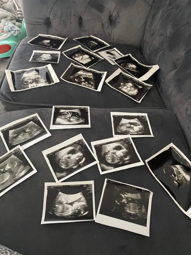 Mãe gasta 10 mil em enxoval rosa e bebê nasce menino