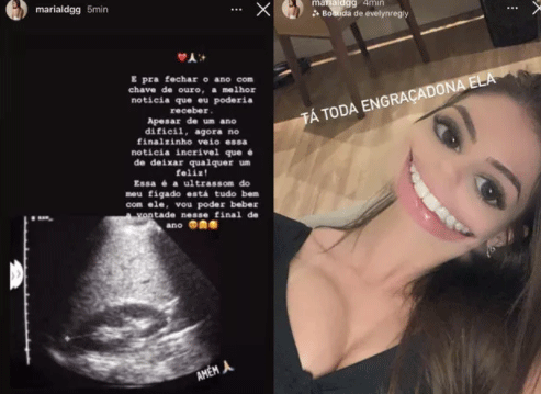 Namorada de Whindersson Nunes publica ultrassom e anima seguidores