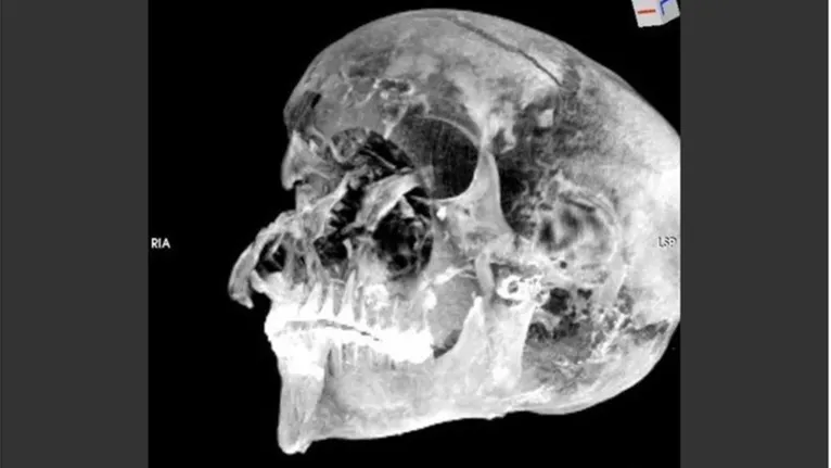 Tomografia em múmia revela que faraó foi morto a machadadas