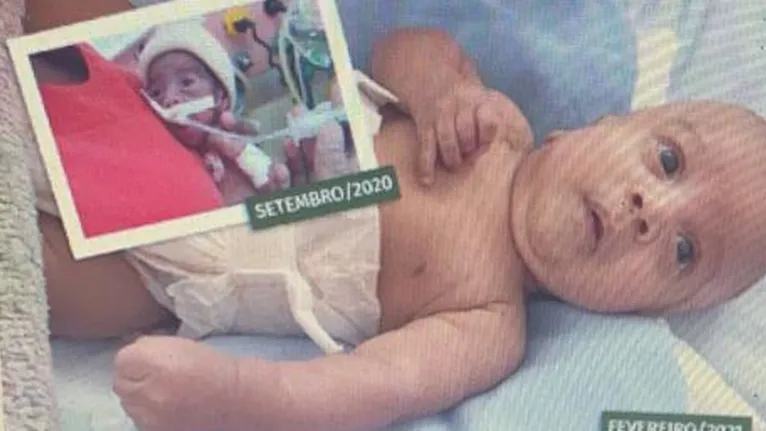 Bebê que nasceu com 738 gramas recebe alta após 5 meses internado