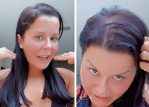 Maraísa revela que sofre de alopecia: "sou carequinha aqui em cima"