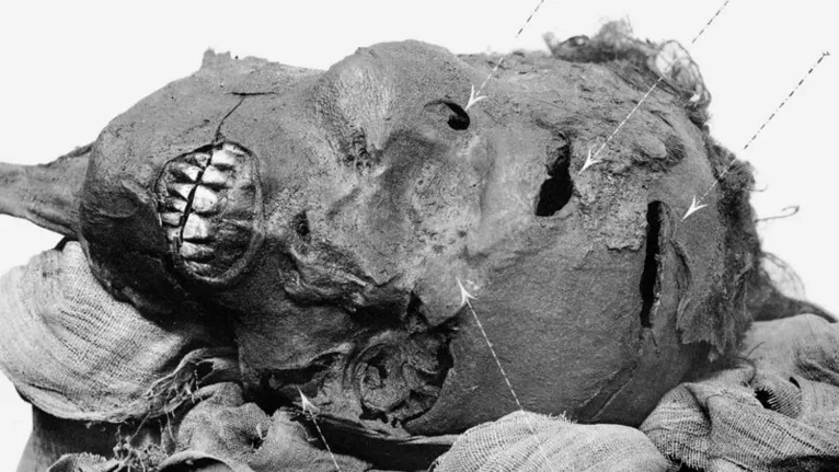 Tomografia em múmia revela que faraó foi morto a machadadas