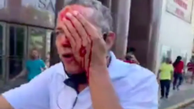Um dos manifestantes que ficou ferido durante o ato