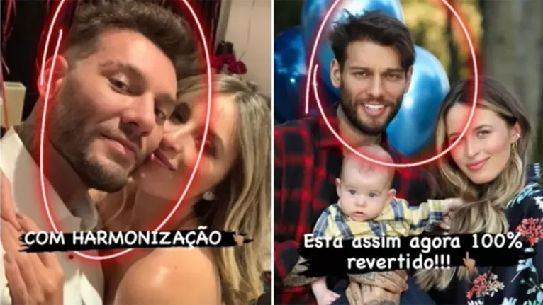 O cantor Lucas Lucco com a harmonização facial (esquerda) e sem o procedimento (direita). 