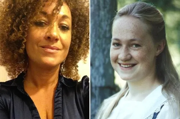 Antes e depois da ativista Rachel Dolezal