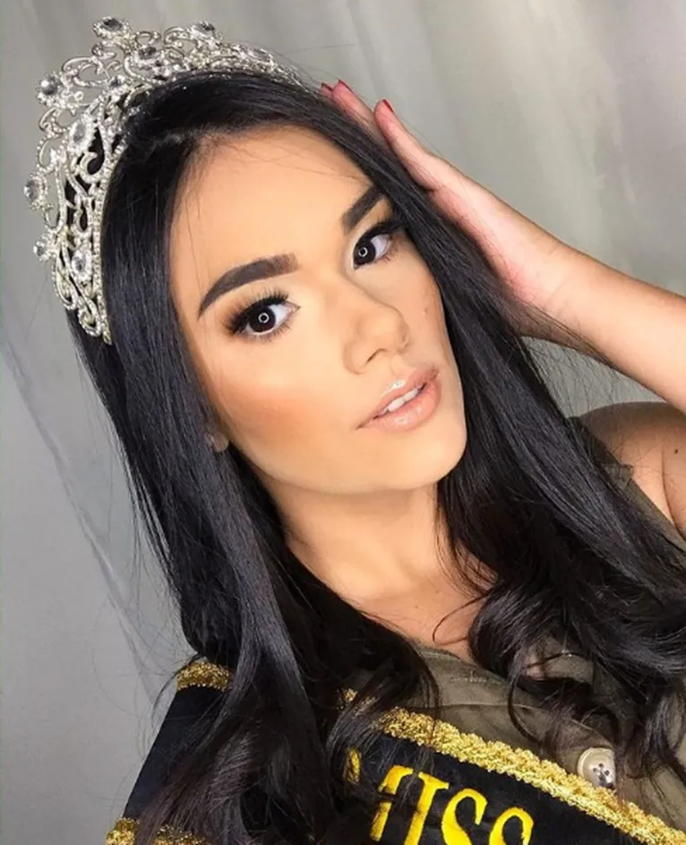 Miss Roraima morre aos 21 anos após cirurgia no abdômen 