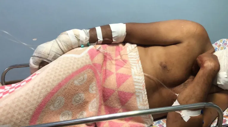 Valderes Pereira da Silva ainda está hospitalizado e deve passar por cirurgia