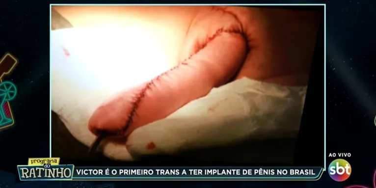 Ratinho mostra pênis ao vivo: "olha o tamanho do berimbau"